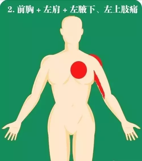 11.20心梗救治日丨咸阳市第一人民医院在行动