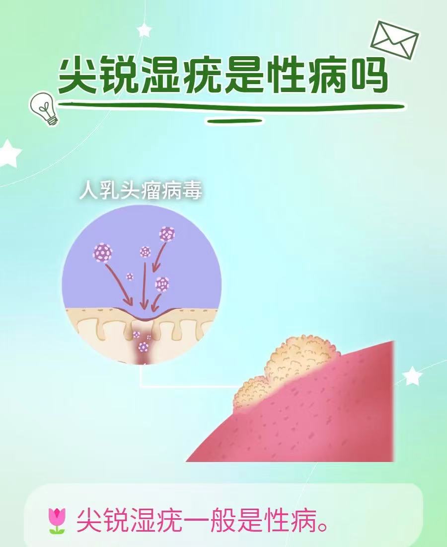 尖锐湿疣揭秘